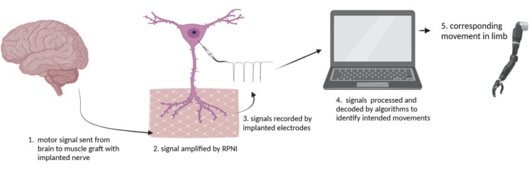 Diagram of the regenerative peripheral nerve interface mechanism showing a motor signal reaching an implanted nerve within a muscle graft, amplification, electrode recording and decoding to drive a prosthesis