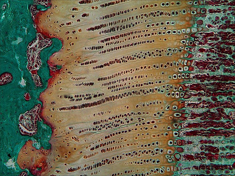 Histology of a growth plate showing chondrocytes arranged in columns transitioning to the ossification front with vascular invasion and new bone