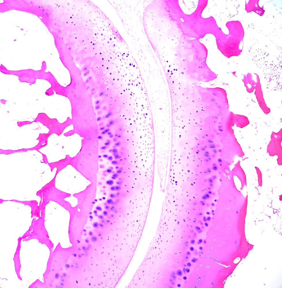 H&E histology of a lesser metatarsophalangeal joint showing the two opposing articular hyaline cartilage surfaces and subchondral bone.