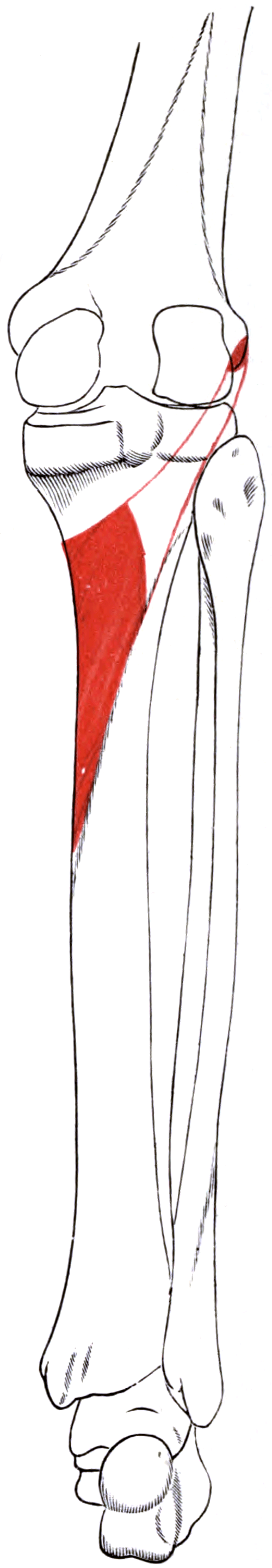 Diagram of the right popliteus muscle outline with its bony origin and insertion areas shaded on the femur and tibia.