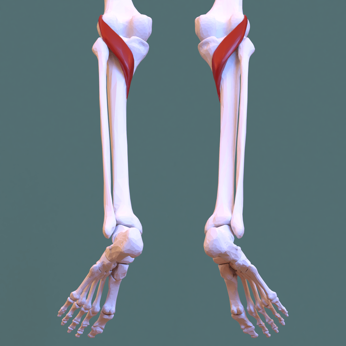 Posterior view of the knee and proximal leg with the triangular popliteus muscle highlighted deep in the popliteal fossa.