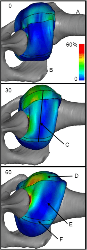 Finite-element biomechanical model of glenohumeral contact pressure at 0, 30 and 60 degrees