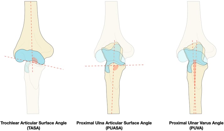 Diagrams defining the trochlear articular surface angle, proximal ulna articular surface angle and proximal ulnar varus angle