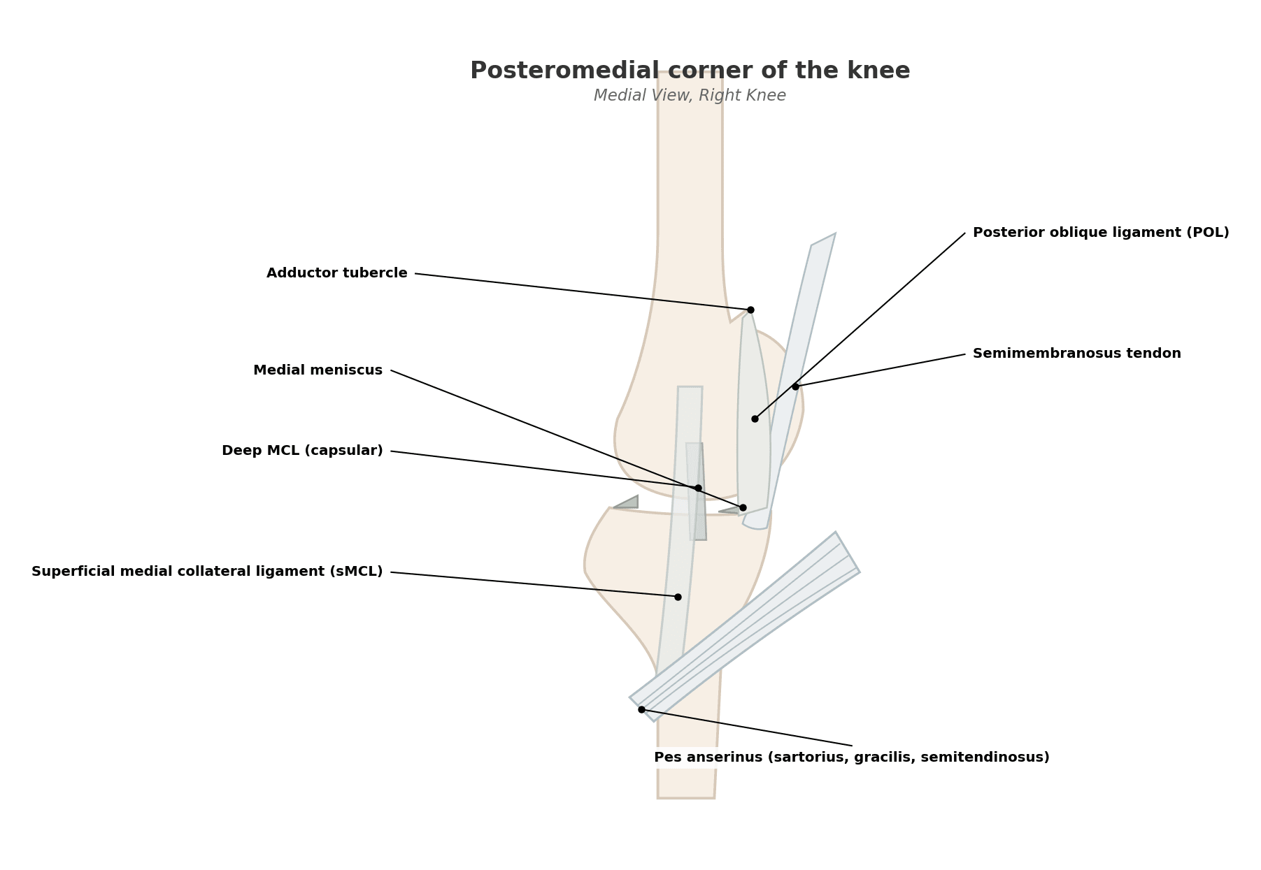 Medial view of the knee showing the posteromedial corner structures - superficial and deep MCL, posterior oblique ligament, semimembranosus and pes anserinus