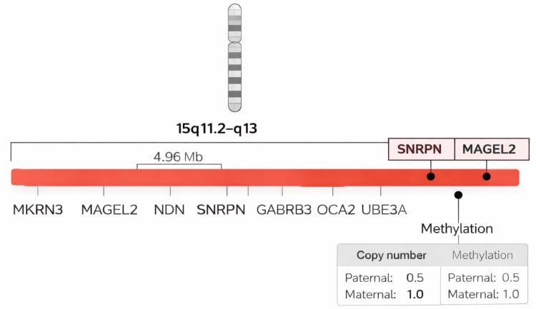 Paternal 15q11–q13 deletion and methylation map