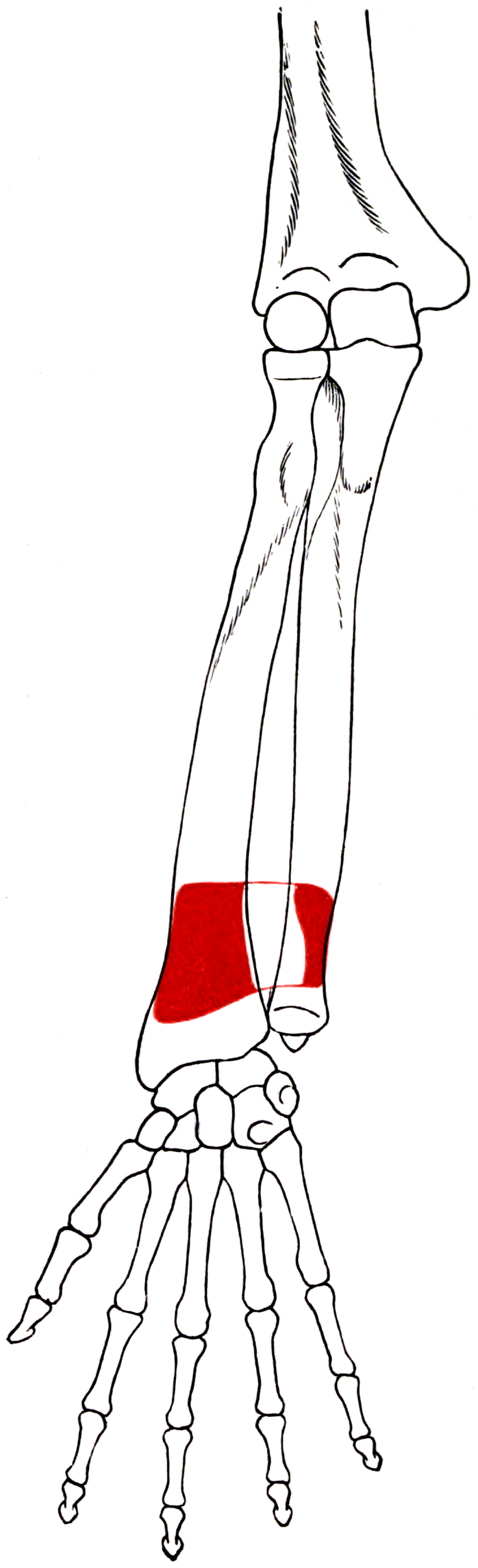Diagram of the right pronator quadratus with its attachment areas marked on the distal ulna and radius.