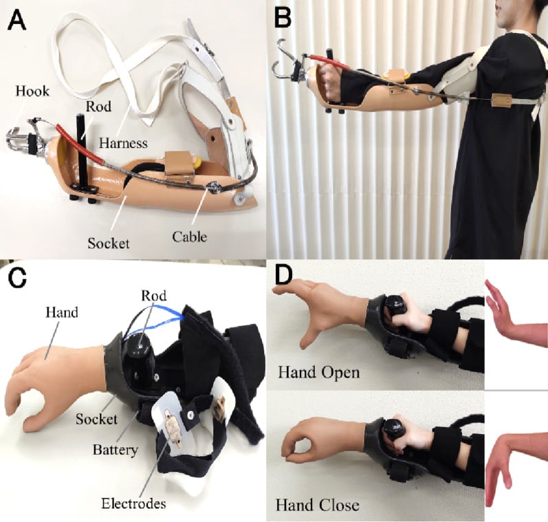 Body-powered hook system with harness and cable beside a myoelectric hand with electrodes and battery