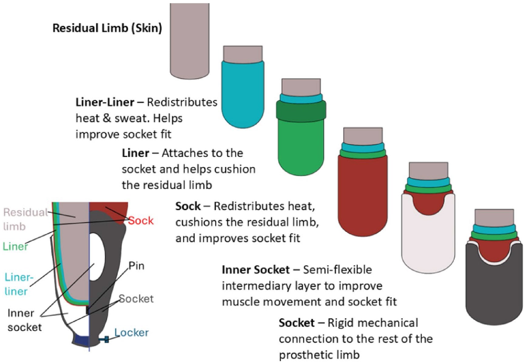 Exploded diagram of residual limb, liner, sock, inner socket and distal pin-lock suspension