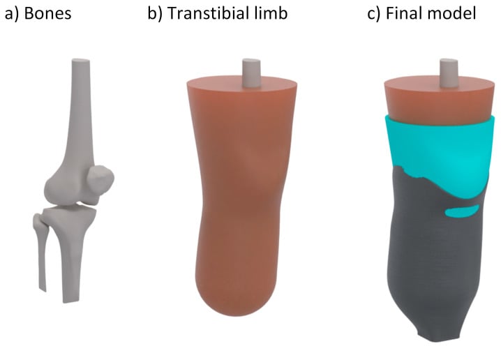 Three-part model showing transtibial bones, the residual limb, and the final model with a socket over the limb