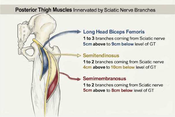 Schematic of the posterior thigh showing sciatic nerve motor branches to biceps femoris long head, semitendinosus and semimembranosus, with branch counts and levels relative to the greater trochanter