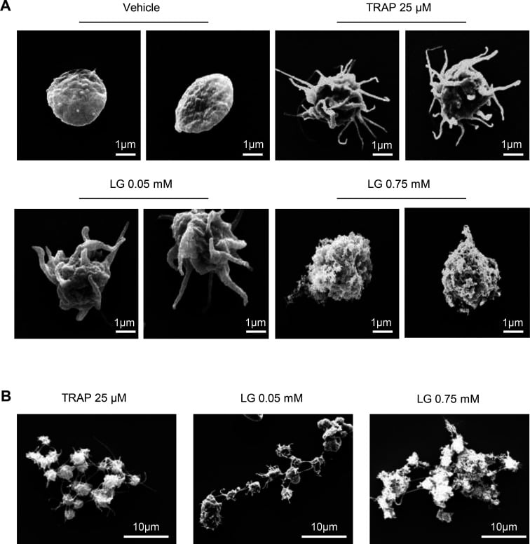 Scanning electron microscopy of resting and experimentally stimulated human platelets showing progressive shape change and aggregation.