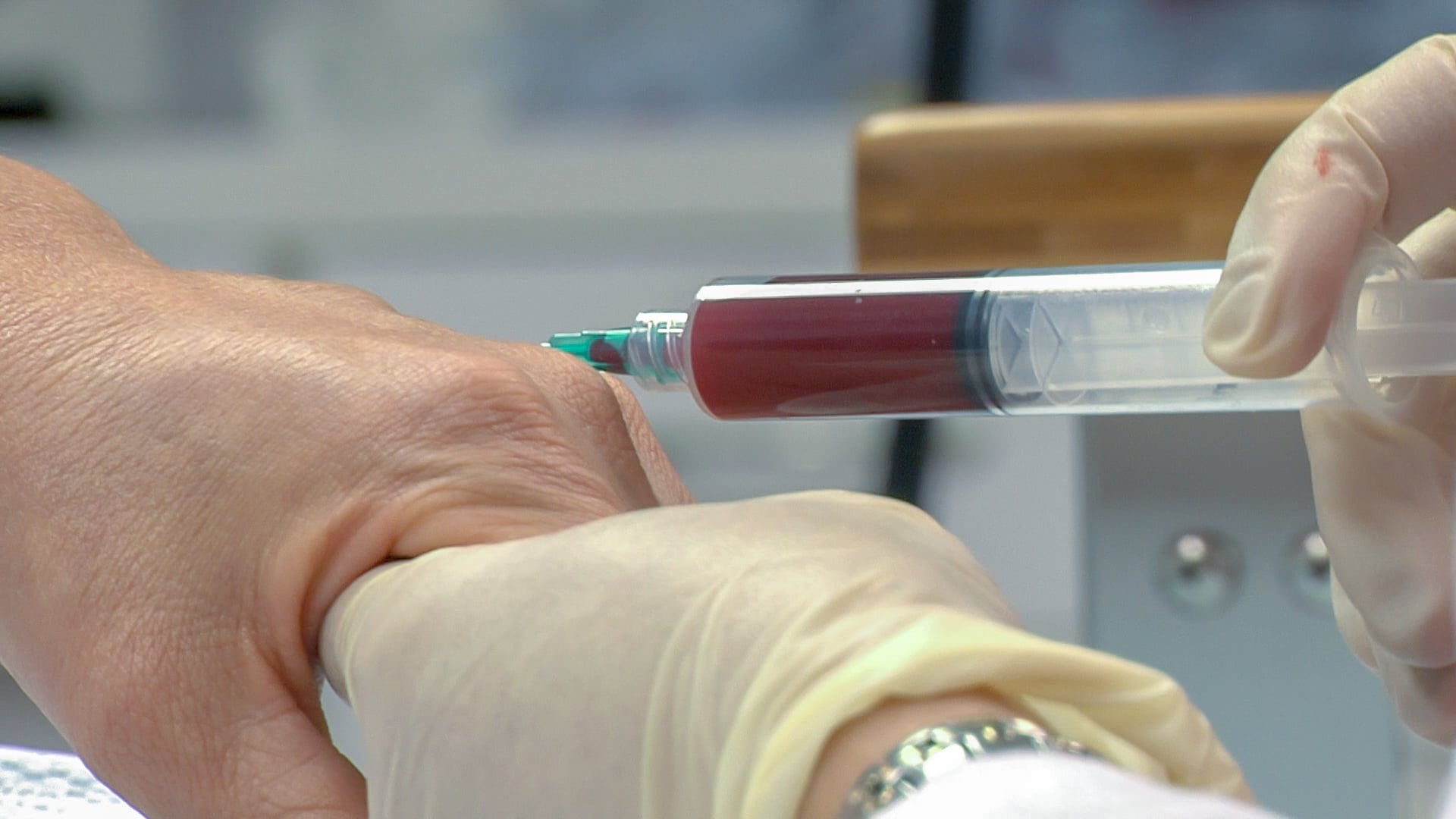 Gloved clinician injecting a blood-derived platelet-rich plasma preparation into a patient's hand