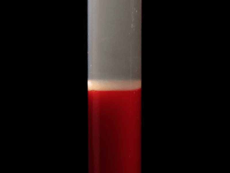 Centrifuged blood tube showing plasma on top, a thin buffy coat layer, and red cells at the bottom
