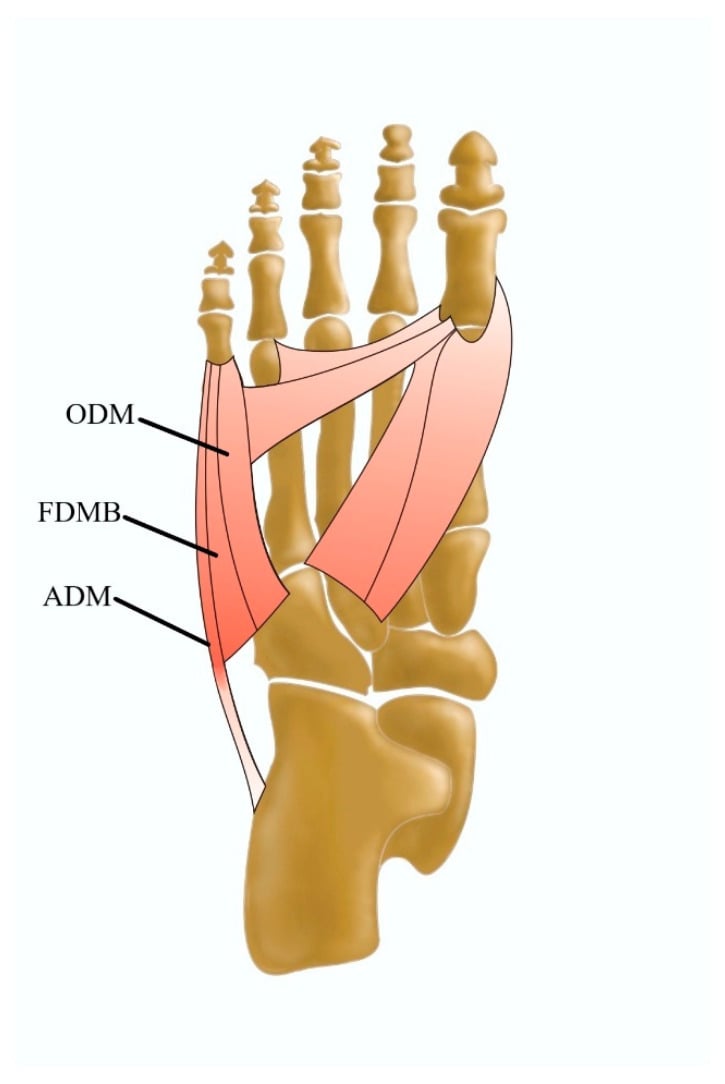 Plantar diagram of the lateral foot showing abductor digiti minimi, flexor digiti minimi brevis and opponens digiti minimi at the fifth metatarsal