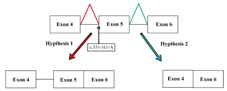 Diagram of two possible RNA-splicing effects of a CHRNG splice-site variant