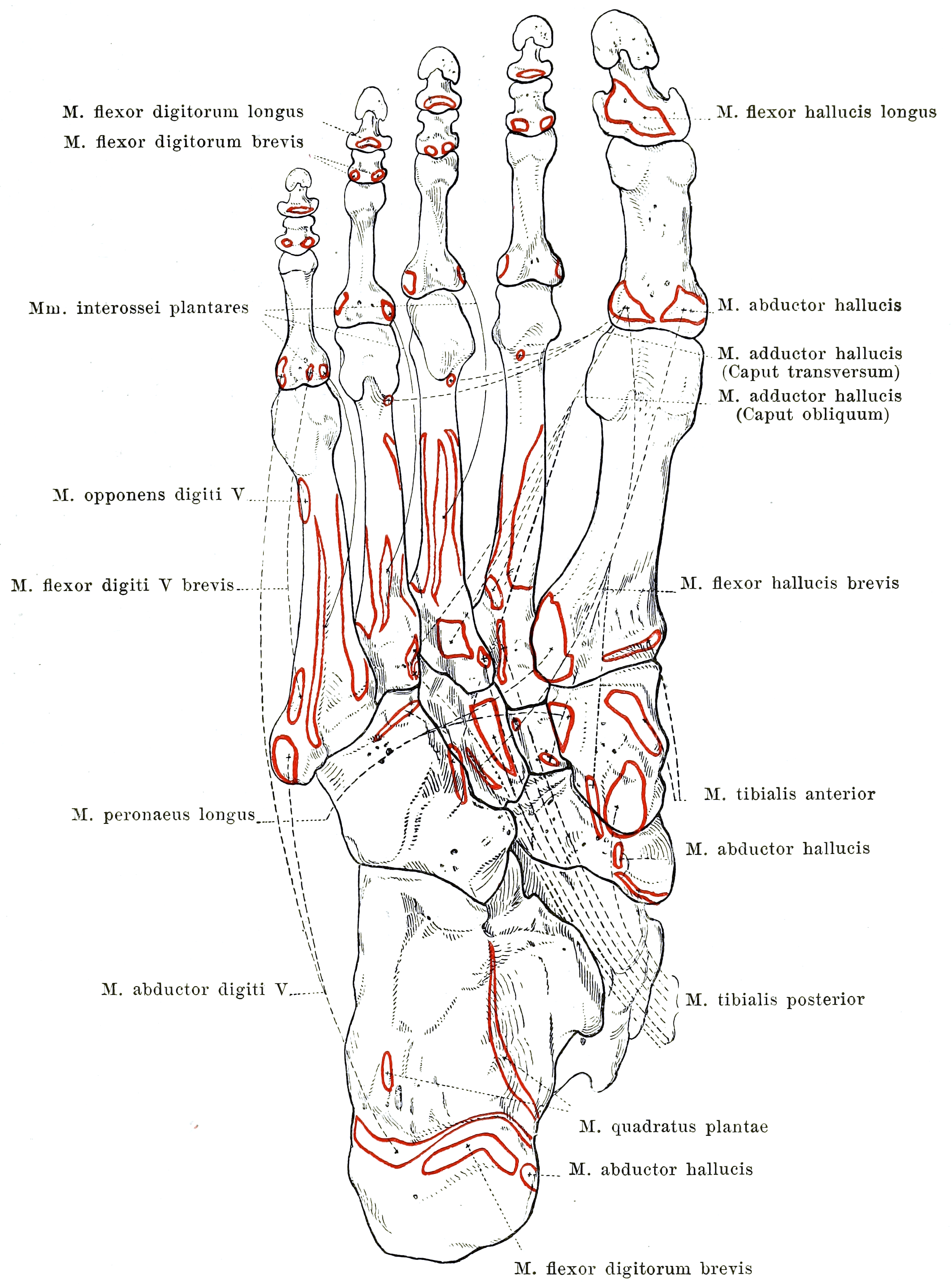 Public-domain plantar attachment diagram of the right foot with quadratus plantae labelled at the calcaneus among other muscle attachment areas.