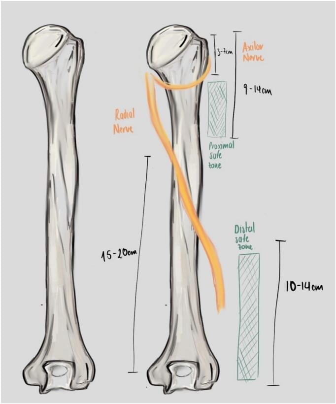 Posterior humeral radial-nerve course and operative safe zones