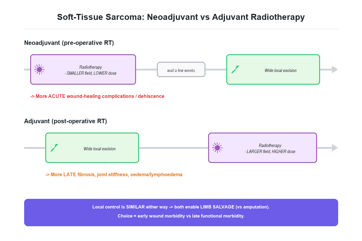 Treatment-timeline diagram contrasting neoadjuvant (pre-operative) radiotherapy then wide local excision with wide local excision then adjuvant (post-operative) radiotherapy for soft-tissue sarcoma