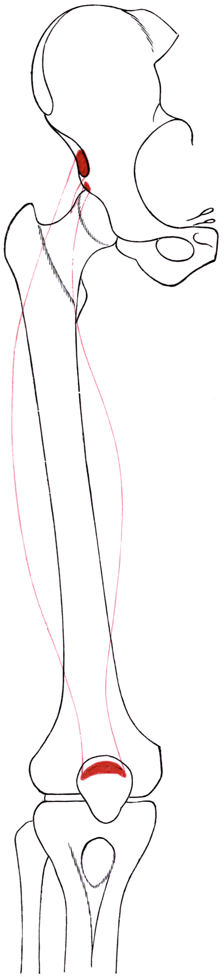 Public-domain outline of the right rectus femoris from its direct and reflected pelvic origins to the patella, with attachment areas shaded red.
