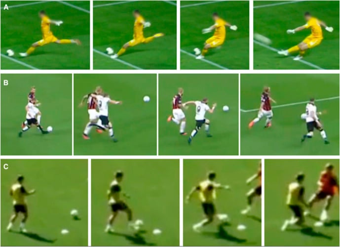 Video sequences of kicking, sprinting and change-of-direction rectus femoris injury mechanisms