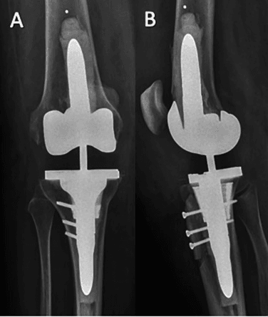 Varus-valgus constrained revision knee with metaphyseal support and stem fixation