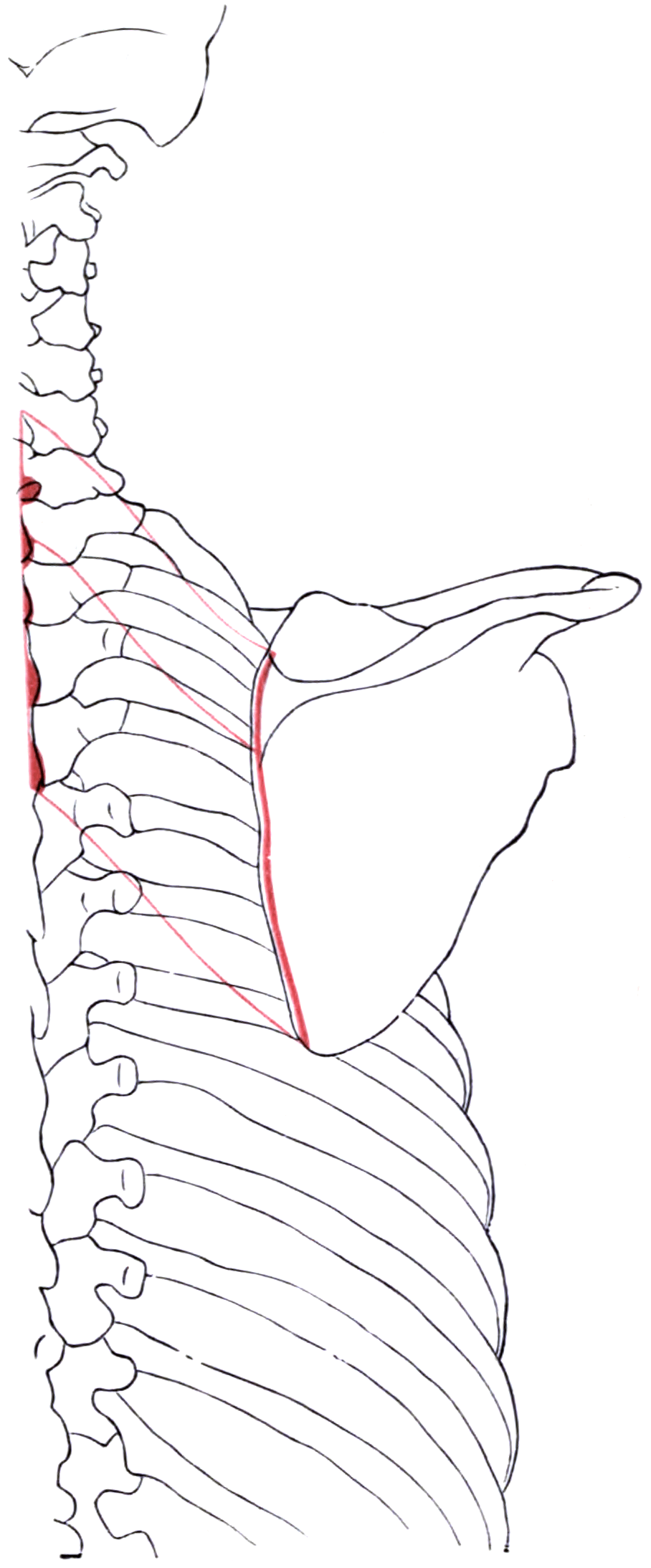 Diagram of the right scapula and thoracic vertebrae with the outlines and attachment areas of rhomboid minor and major shaded.