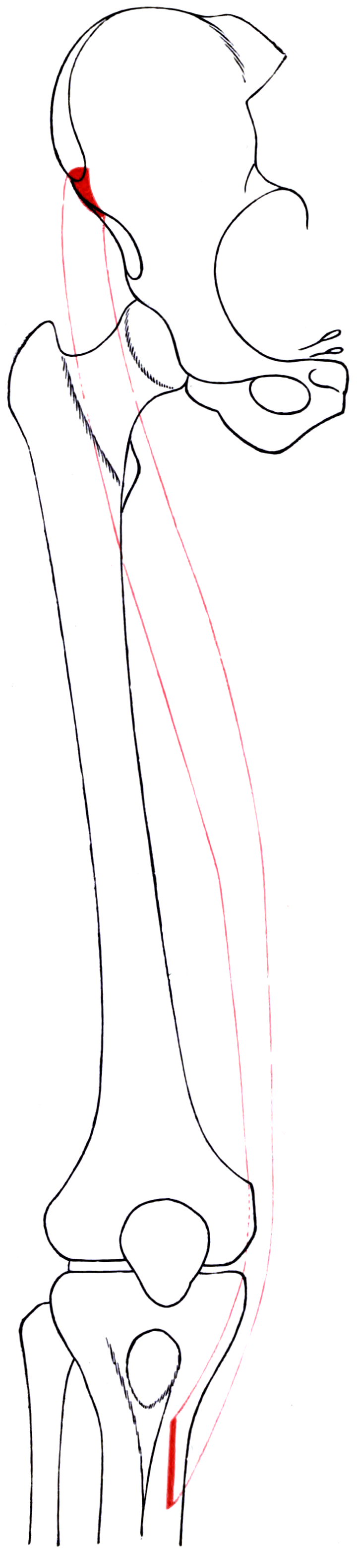 Longitudinal anatomical outline of the right sartorius from the ASIS region to the proximal medial tibia, with attachment areas highlighted in red.