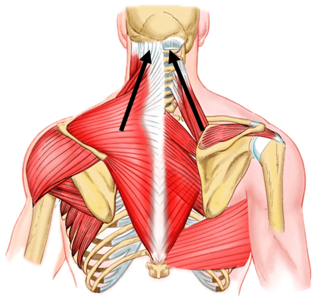 Posterior view of the neck and shoulder muscles with two arrows along the upper trapezius and levator scapulae