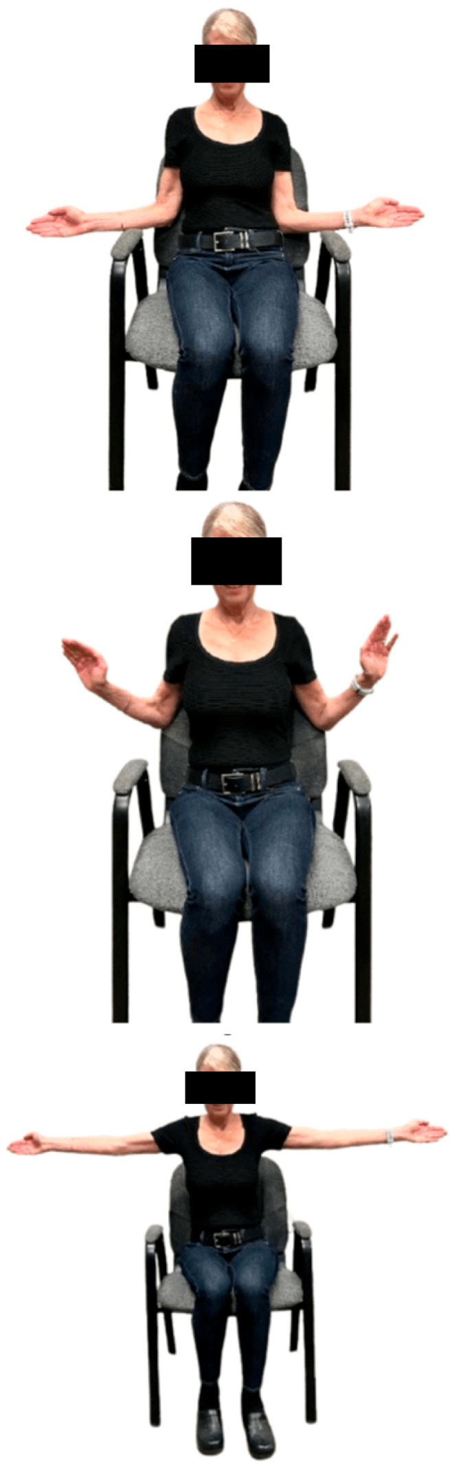 Clothed seated patient demonstrating L, W and T arm positions
