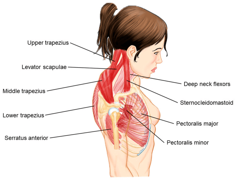 Side view illustration labelling the cervical, pectoral and scapular muscles of the upper-crossed-syndrome model