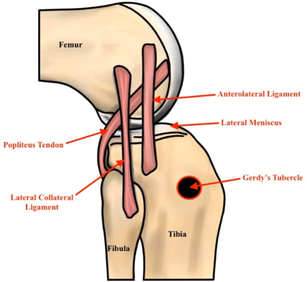 Diagram of the anterolateral ligament and its relationship to the lateral meniscus, lateral collateral ligament, popliteus tendon and Gerdy tubercle