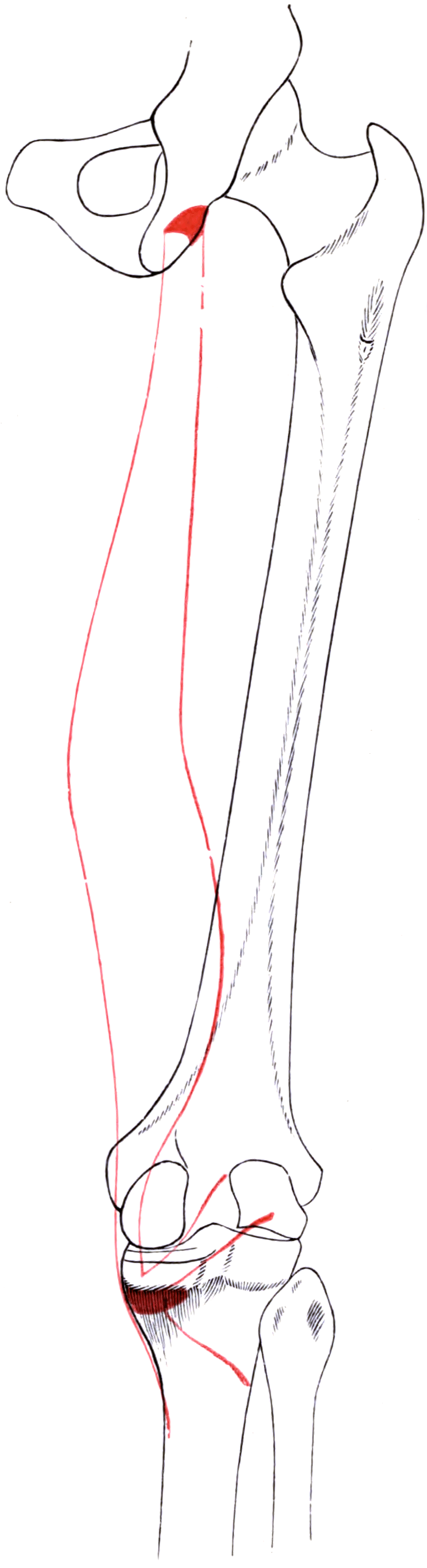 Public-domain outline of the right semimembranosus from the ischial tuberosity to its posteromedial tibial and capsular attachment regions.