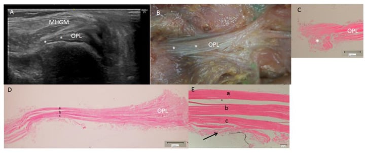 Ultrasound dissection and histology of the oblique popliteal ligament arm