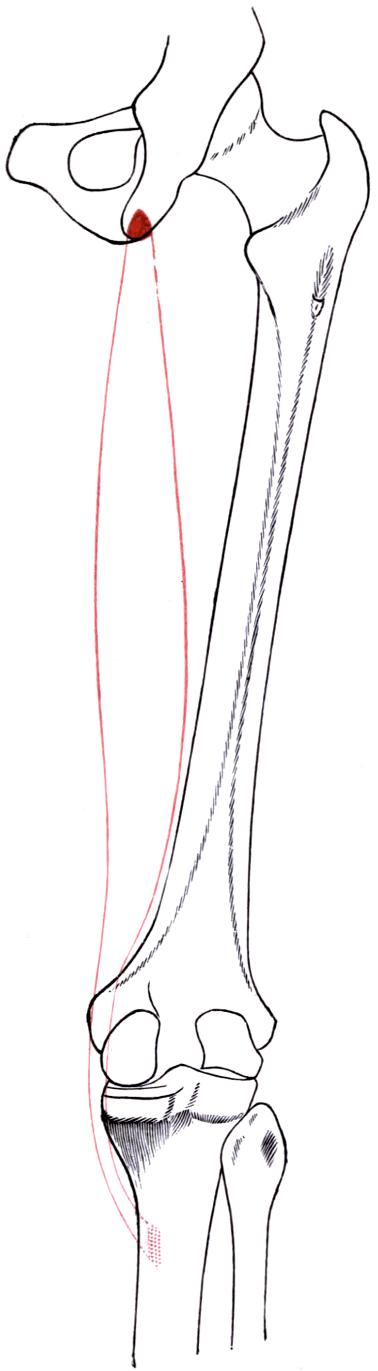 Public-domain outline of the right semitendinosus from its conjoint ischial origin to the superomedial tibial pes anserinus insertion.