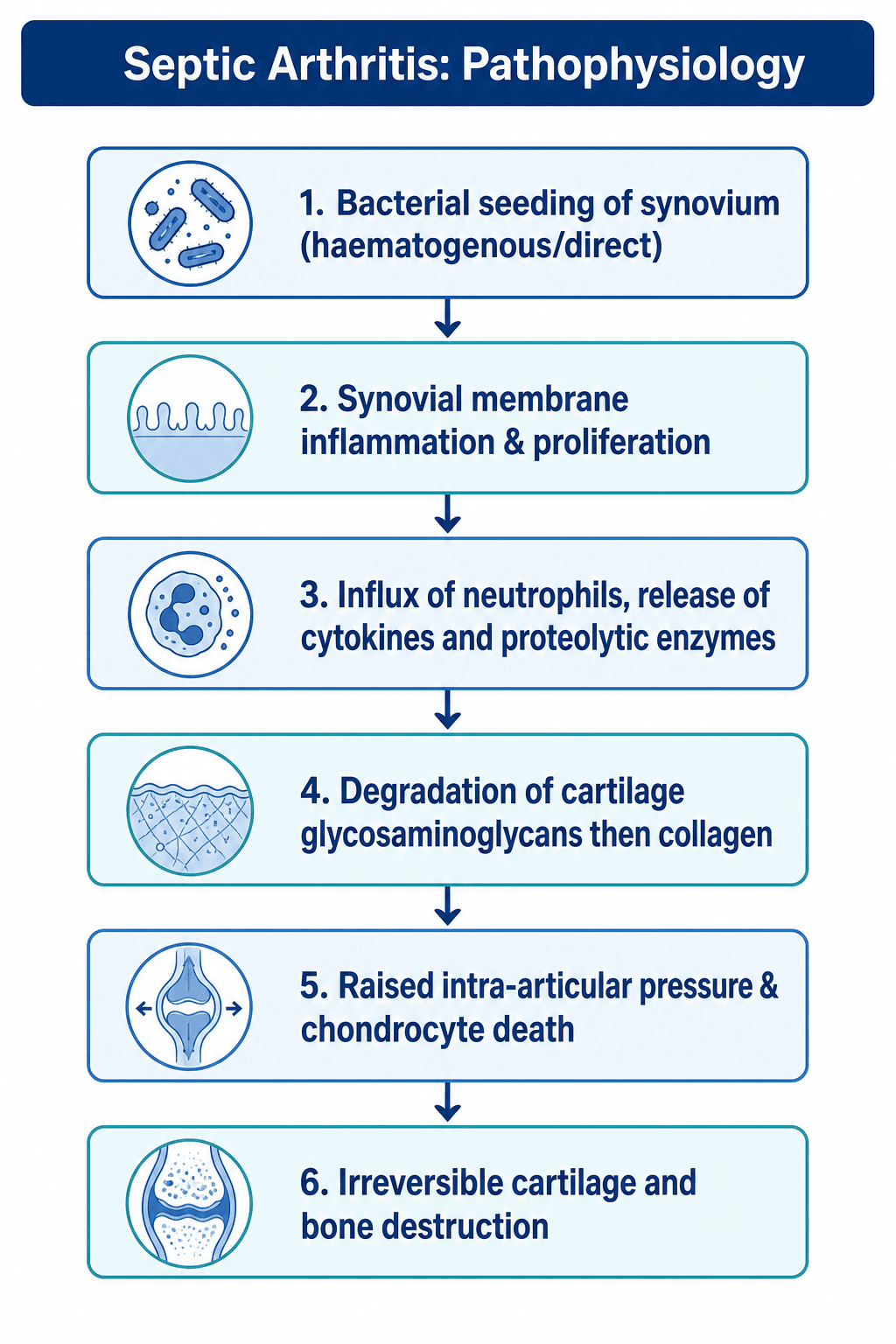 Six-step cascade of septic arthritis pathophysiology from bacterial seeding to irreversible joint destruction.