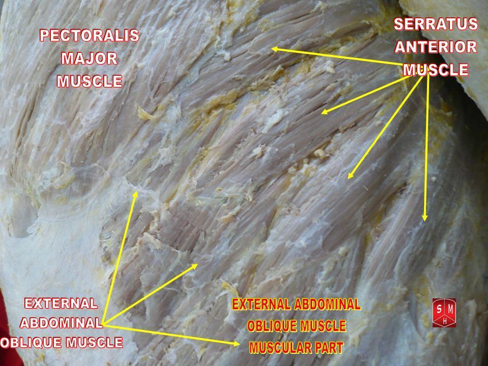 Anatomical dissection displaying the serratus anterior muscle with its serrated slips along the lateral thoracic wall.