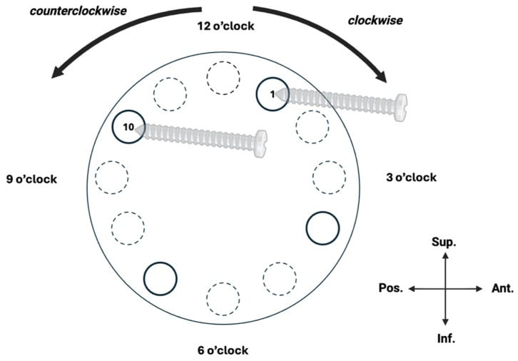 Right glenoid clock-face diagram for reverse shoulder arthroplasty peripheral screw placement
