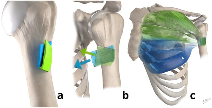 Illustrations of the layered pectoralis major tendon and its humeral insertion