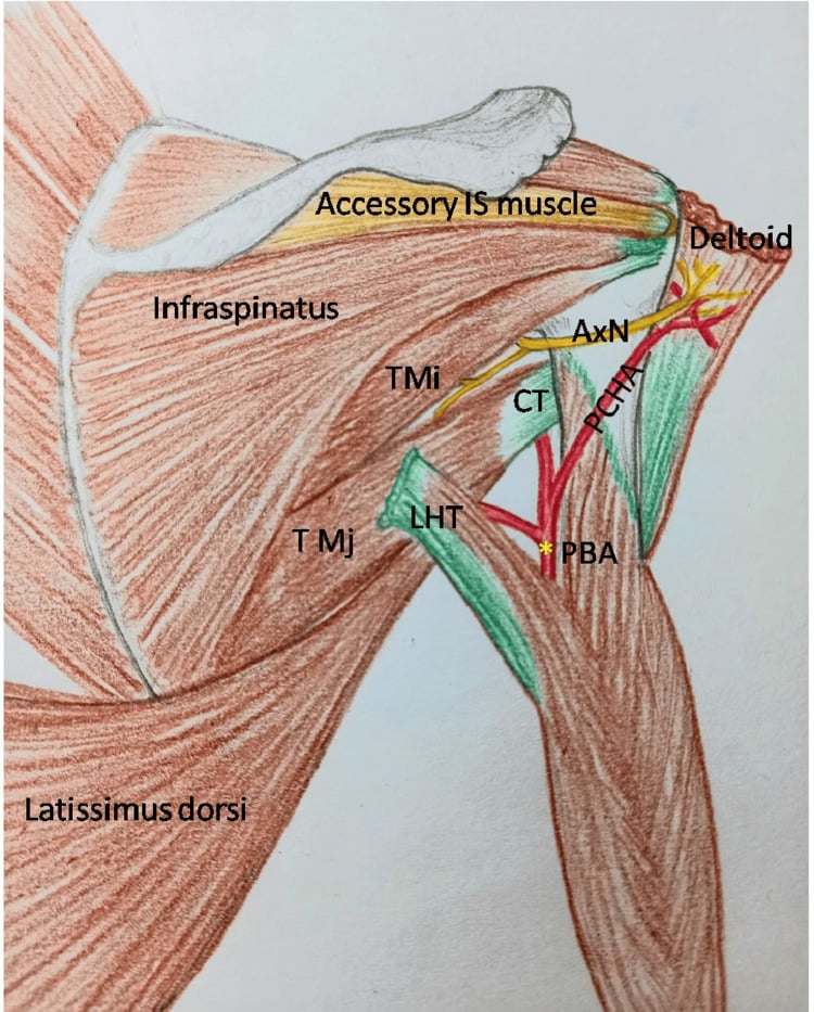 Scapular anatomy diagram showing the axillary nerve and posterior circumflex humeral artery beside the deltoid