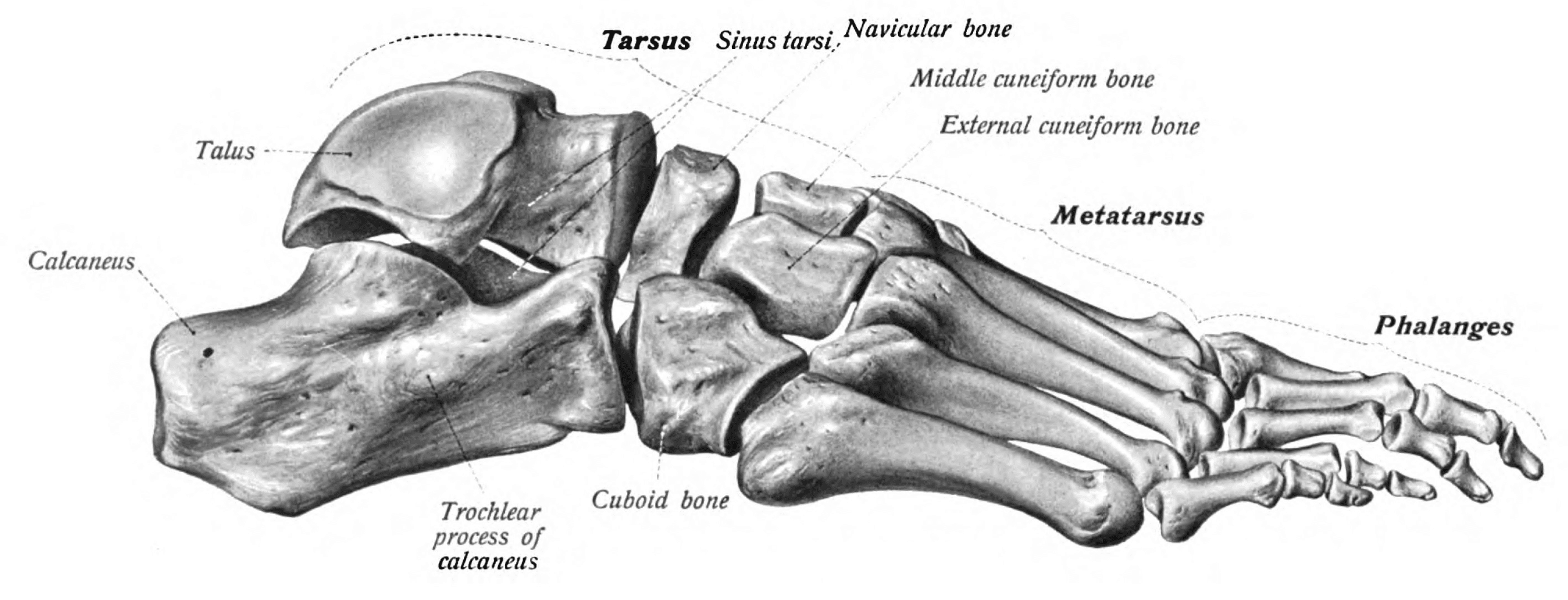 Lateral view of the foot skeleton with the sinus tarsi labelled.