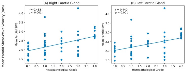 Scatter plots showing correlation between parotid shear-wave velocity and biopsy histopathological grade