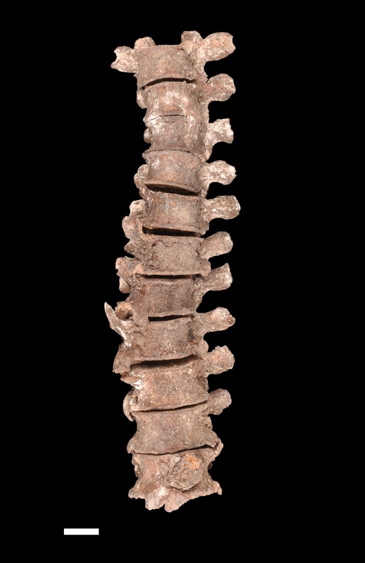 Anatomical specimen of thoracic spine showing flowing vertebral ossification in skeletal fluorosis