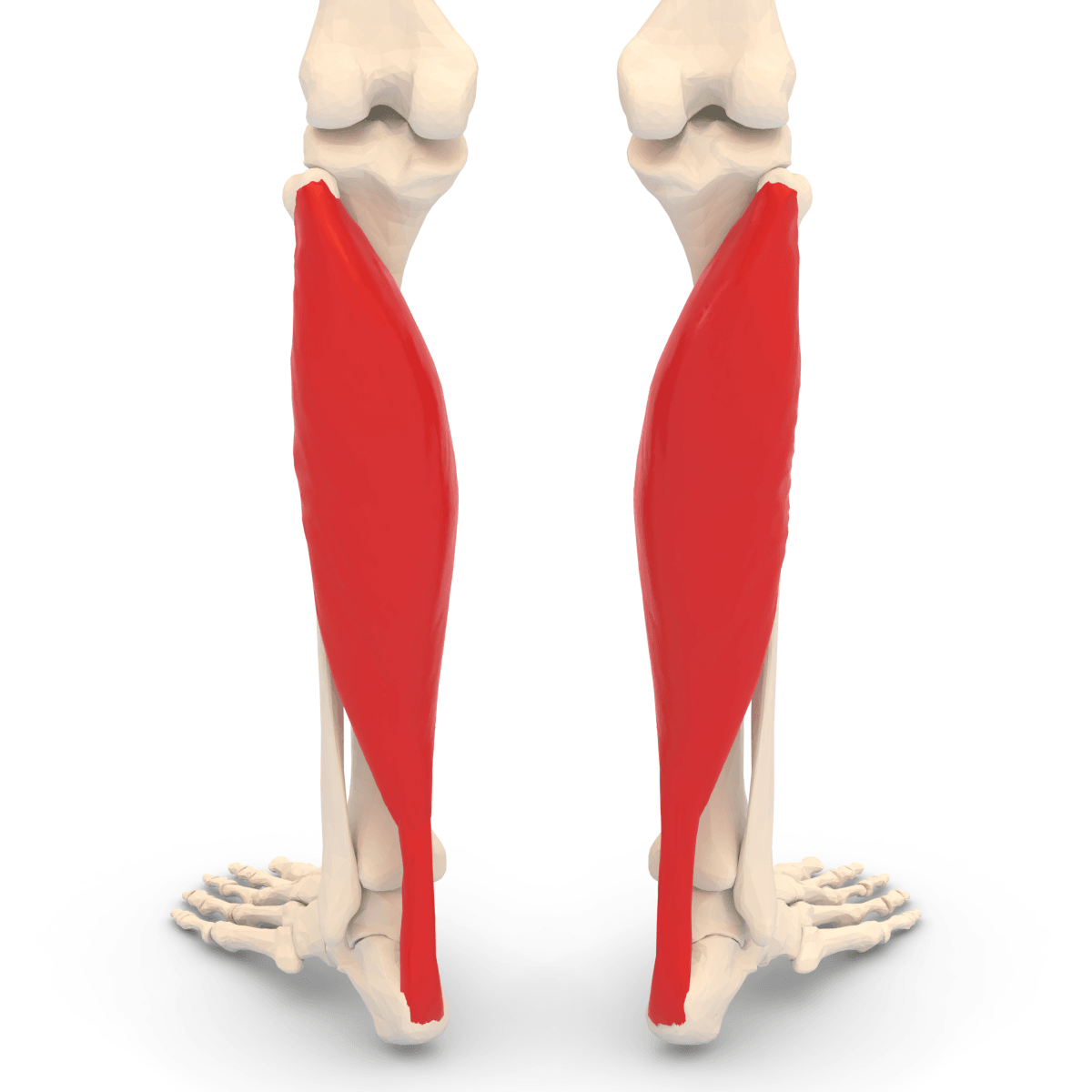 Posterior view of the calf showing the soleus muscle deep to the reflected gastrocnemius.