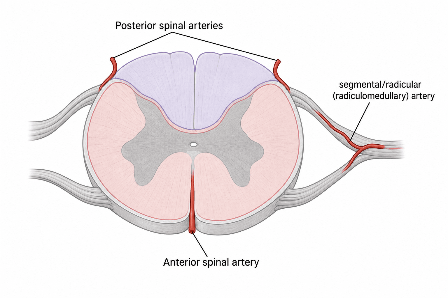 Cross-section of the spinal cord showing the anterior spinal artery, two posterior spinal arteries and a radiculomedullary feeder