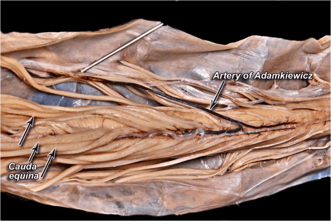 Cadaveric dissection of the artery of Adamkiewicz with the cauda equina and nerve roots