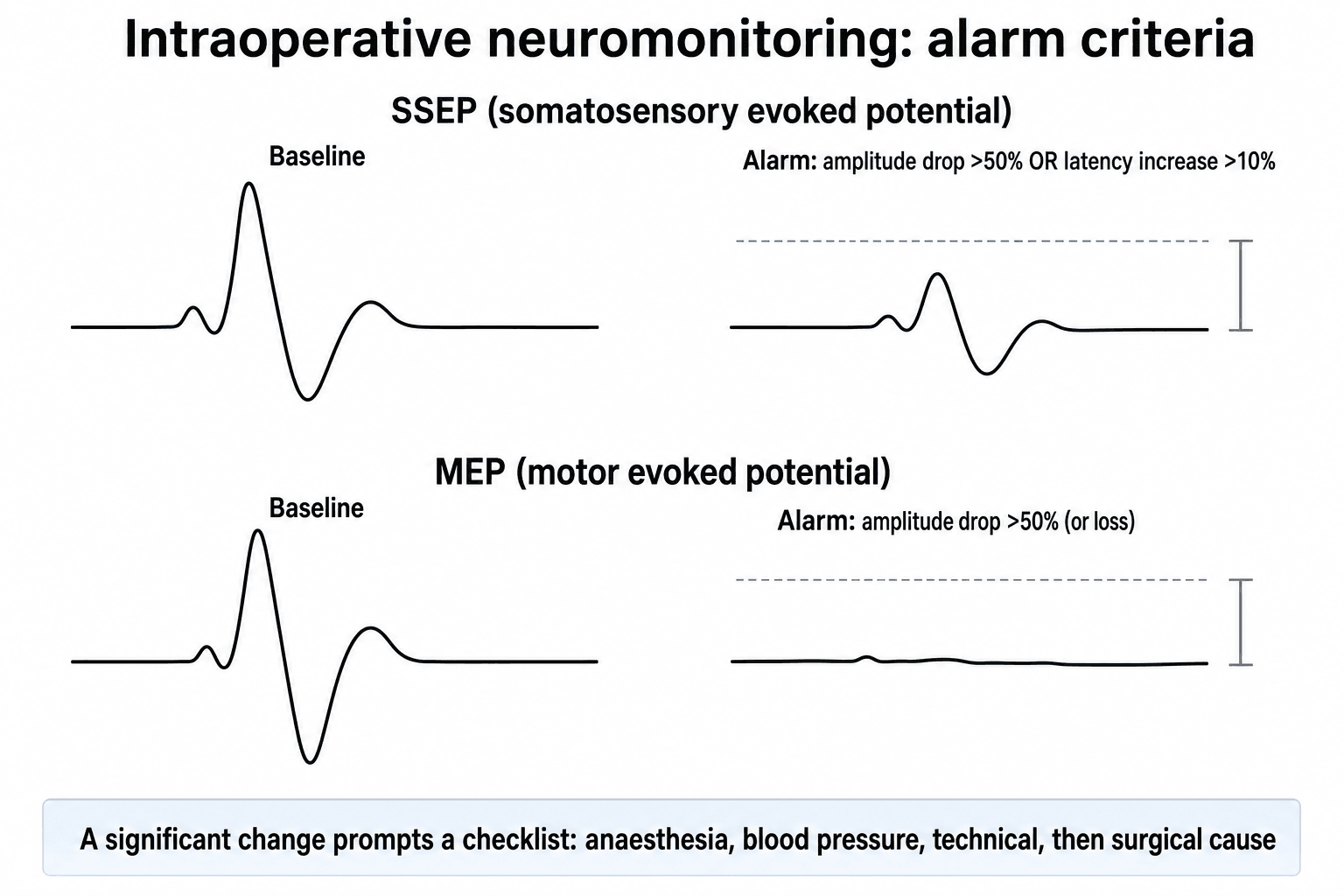 Schematic of evoked-potential alarm criteria: baseline SSEP and MEP waveforms versus reduced-amplitude alarm tracings.