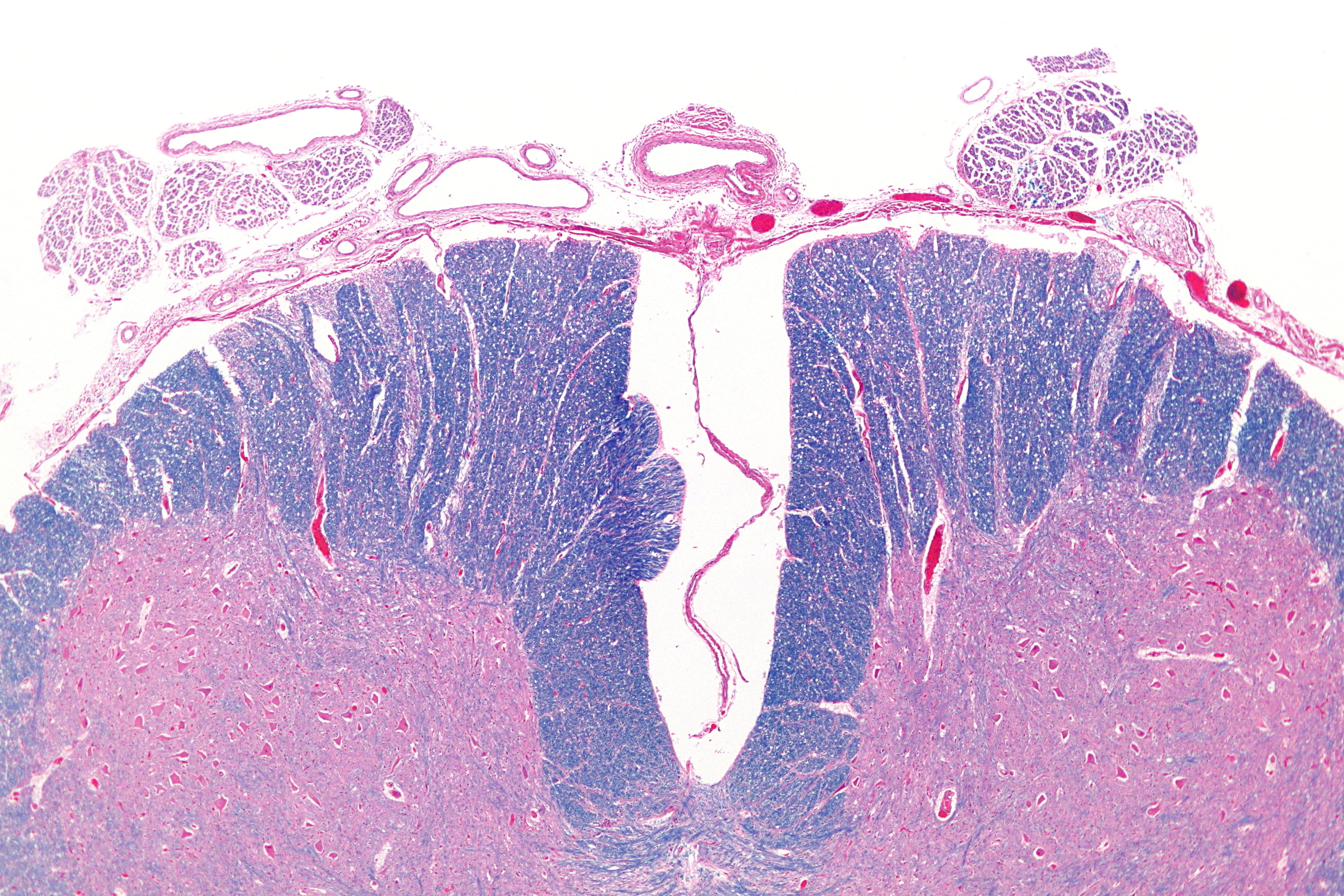 Low-magnification myelin-stained cross-section of the anterior spinal cord showing the anterior spinal artery in the anterior median fissure.