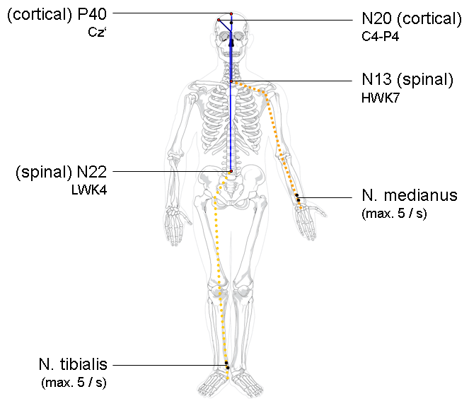 Schematic of somatosensory evoked potential recording: median and tibial nerve stimulation with spinal and cortical recording peaks (N13, N20, N22, P40)