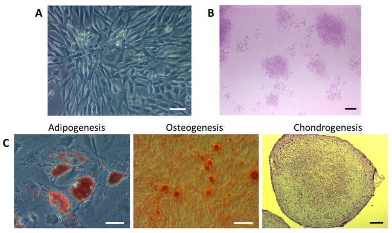 Phase-contrast morphology, CFU-F colonies and trilineage staining of adipose-derived MSCs.