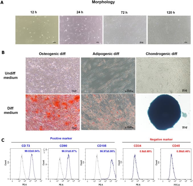 Characterization panel of umbilical-cord MSCs: morphology over time, multilineage staining and flow-cytometry marker profile.